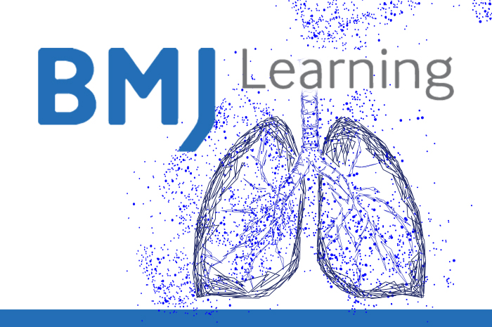 Step by step: come diagnosticare l'embolia polmonare